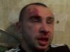 В Донецке напали на журналиста «Дорожного контроля»
