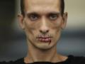 Петербургский художник зашил рот в знак протеста 