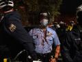 BLM: в США продолжаются столкновения с полицией