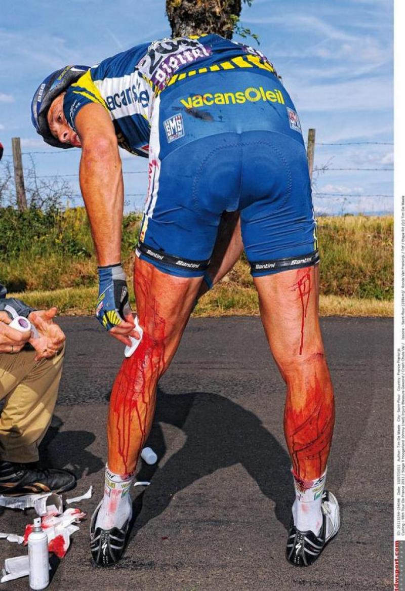 Болят колени после велосипеда. Ноги велосипедистов тур де Франс. Ноги велогонщика тур де Франс. Тур де Франс ноги гонщика. Мышцы велосипедиста после тур де Франс.