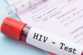 Борьба с ВИЧ: в Минздраве озвучили количество инфицированных