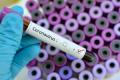 В Германии подхватили коронавирус уже 11 человек, все связанны с компанией Webasto