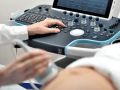 Як вибрати УЗД апарат: поради для лікарів та медичних центрів