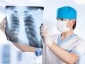 Эпидемия туберкулеза в Украине: врачи рассказали, как уберечься от заболевания