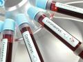 В Украине лабораторно подтвердили 14 случаев коронавируса, два - летальные