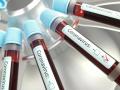 В Украине зафиксировали уже 145 случаев коронавирусной инфекции