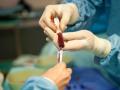 В Украине повысили тарифы на операции по трансплантации