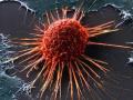 В распространении рака виновато человечество - ученые