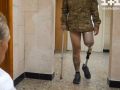 Щонайменше 25 тис. українців втратили кінцівки через війну – Sky News