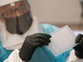 У Росії заспокоюють через віспу мавп: подробиці гучної заяви