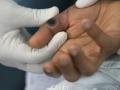 У РФ слідом за чумою — спалах нової смертельної хвороби: під Москвою заражені люди