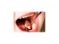 Молочные зубы: лечить или не лечить