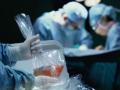 Трансплантация органов: В Украине с 1 января будут остановлены все операции 