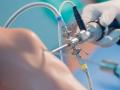 Что такое малоинвазивная хирургия?