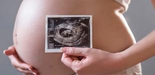 УЗД під час вагітності: як і навіщо