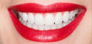 Повна імплантація зубів: сучасне рішення для відкритої усмішки