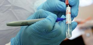 В Беларуси обнаружили еще около 500 случаев коронавируса за сутки