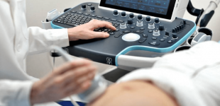 Як вибрати УЗД апарат: поради для лікарів та медичних центрів