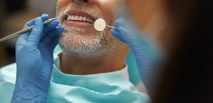 Успішні імплантації для літніх пацієнтів у клініці KES