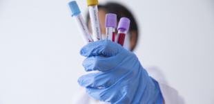 В Украине начали производить тесты на коронавирус — секретарь СНБО