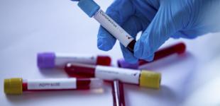 Киевлян просят сообщать о возвращении из стран с коронавирусом