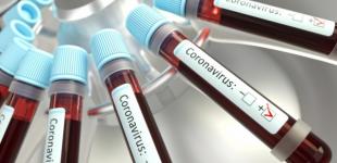 В России из-за коронавируса умерли уже 43 человека