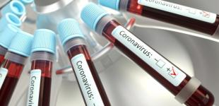 В Украине выявили 26 999 случаев коронавируса, за сутки - 485