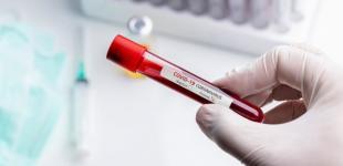 В Бразилии за сутки зафиксировали более 900 смертей от коронавируса