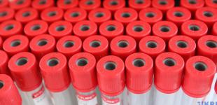 У Росії четвертий день поспіль - найбільше випадків COVID-19 з початку пандемії