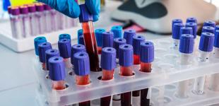 Украину признали страной с высокими темпами распространения COVID-19