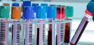 Казахстан бьет антирекорды - за сутки более 1800 инфицированных COVID-19