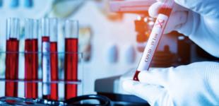 Официально количество новых случаев COVID-19 в России снижается