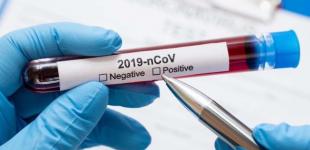 Вакцина от COVID-19 появится в декабре - главный инфекционист США