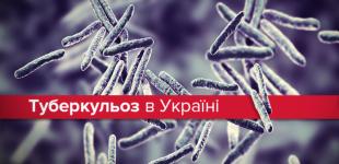 Минздрав внедряет целевое обследование на туберкулез