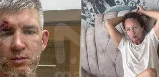 Побила сковорідкою і засунула голову у смітник: у Криму жінка ледь не уколошкала чоловіка за підтримку війни в Україні