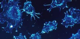 В Израиле пообещали полноценное лекарство от рака 