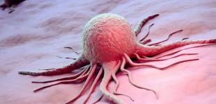 Люди стали чаще болеть раком - ученые 