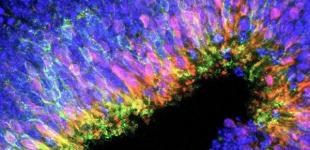 Биологи вырастили сетчатку глаза в пробирке 