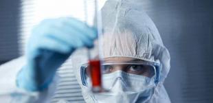 Украина первой в мире научилась прогнозировать осложнения при COVID по анализу крови