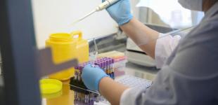 Украина ожидает первую партию тест-систем для выявления коронавируса