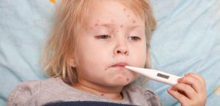 Корь и прививки: обзор мнений