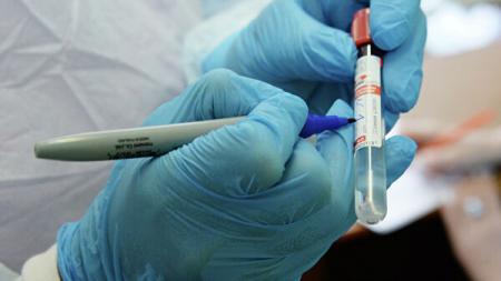 В Беларуси обнаружили еще около 500 случаев коронавируса за сутки