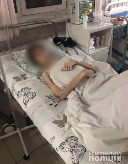 В Одессе отец морил сына голодом - подросток попал в больницу