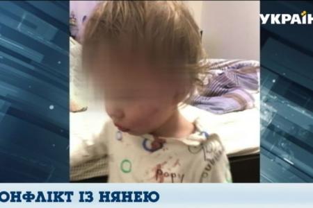 Скандал в Одессе: мать обвиняет няню в избиении годовалого ребенка