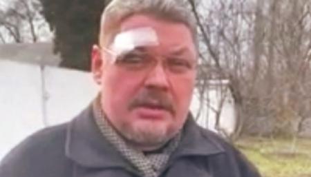 В Черниговской области избили священника ПЦУ
