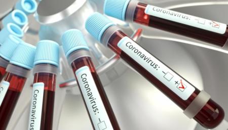 В России из-за коронавируса умерли уже 43 человека