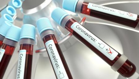 В Украине выявили 26 999 случаев коронавируса, за сутки - 485