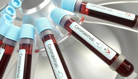 В Украине лабораторно подтвердили 14 случаев коронавируса, два - летальные