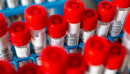 Количество зараженных коронавирусом в Польше превысило 23,3 тысячи