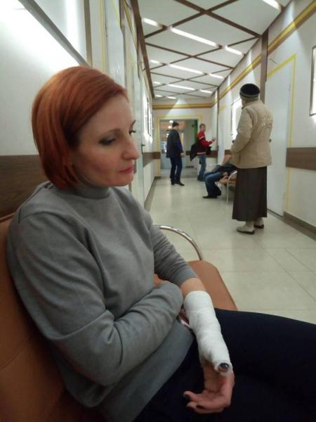 Глава Коцюбинского поселкового совета Ольга Матюшина  травмировала женщину депутата